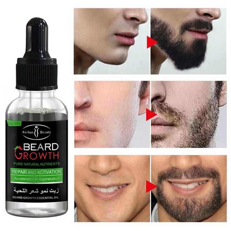 Beard Oil 30ml All Hair Types No Dandruff